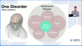 Нейротехнологии: прошлое, настоящее и будущее